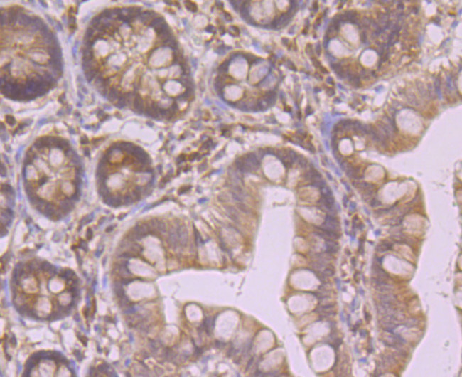 HO-1 Antibody in Immunohistochemistry (Paraffin) (IHC (P))