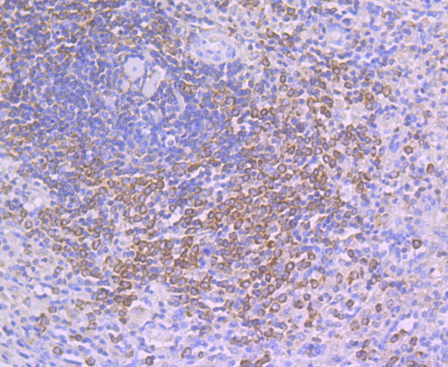 SHP-1 Antibody in Immunohistochemistry (Paraffin) (IHC (P))