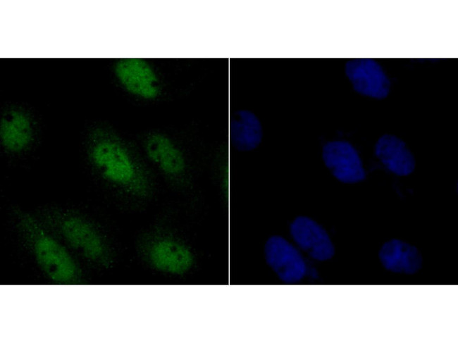 RUNX2 Antibody in Immunocytochemistry (ICC/IF)