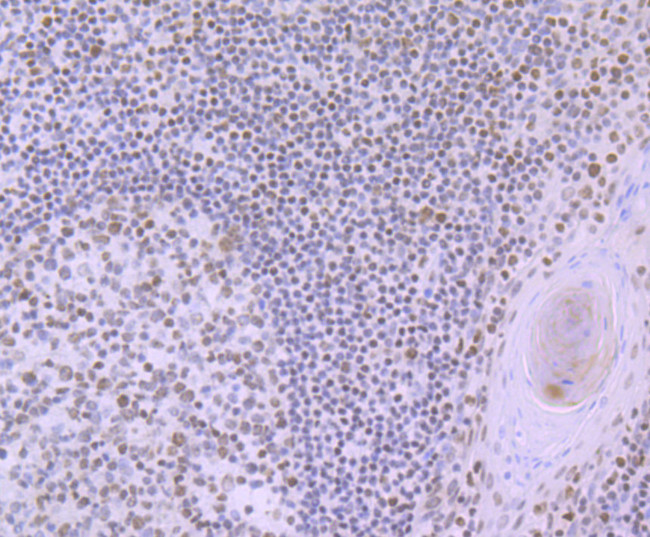 RUNX2 Antibody in Immunohistochemistry (Paraffin) (IHC (P))