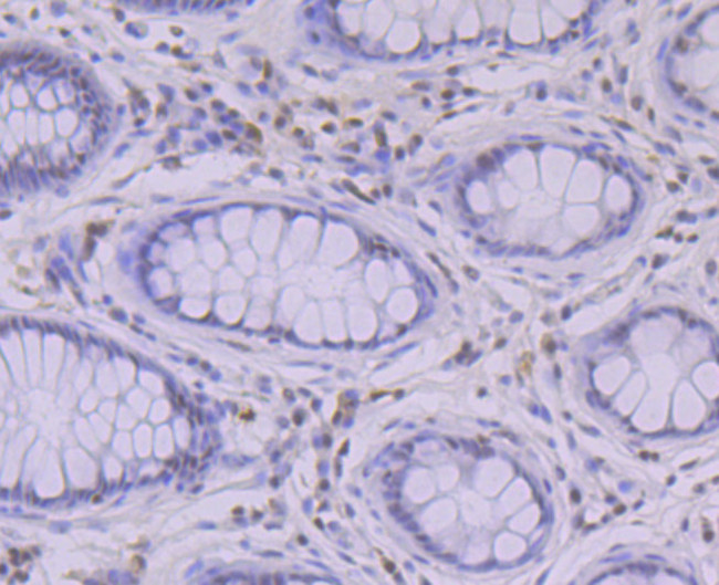 RUNX2 Antibody in Immunohistochemistry (Paraffin) (IHC (P))