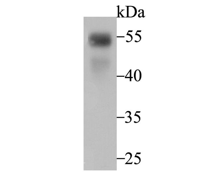 RUNX2 Antibody in Western Blot (WB)