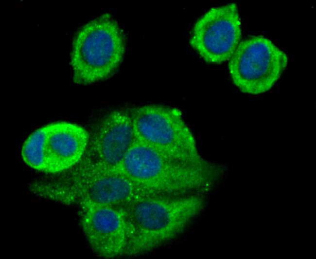 TAK1 Antibody in Immunocytochemistry (ICC/IF)