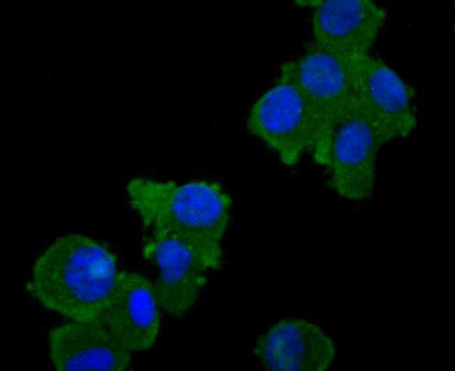 TAK1 Antibody in Immunocytochemistry (ICC/IF)