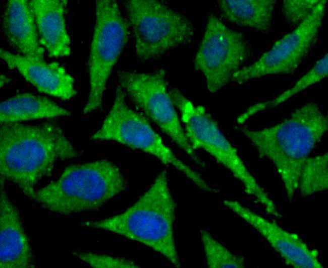 TAK1 Antibody in Immunocytochemistry (ICC/IF)