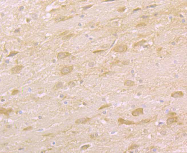 TAK1 Antibody in Immunohistochemistry (Paraffin) (IHC (P))