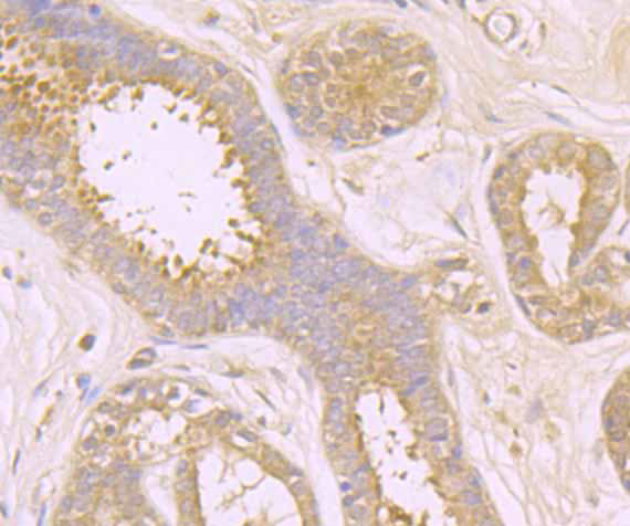 TAK1 Antibody in Immunohistochemistry (Paraffin) (IHC (P))