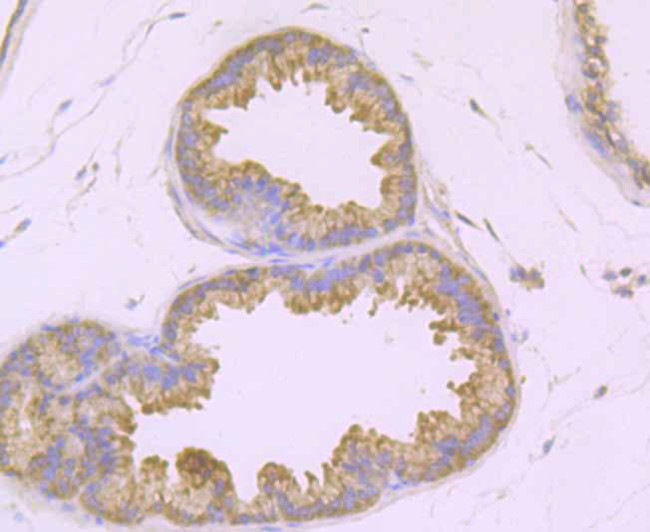 TAK1 Antibody in Immunohistochemistry (Paraffin) (IHC (P))