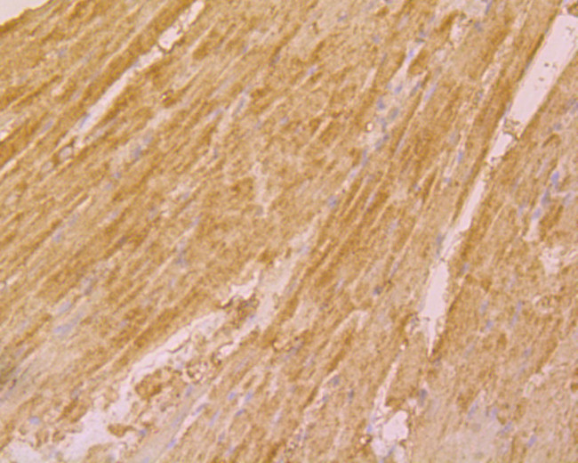 UQCRC2 Antibody in Immunohistochemistry (Paraffin) (IHC (P))