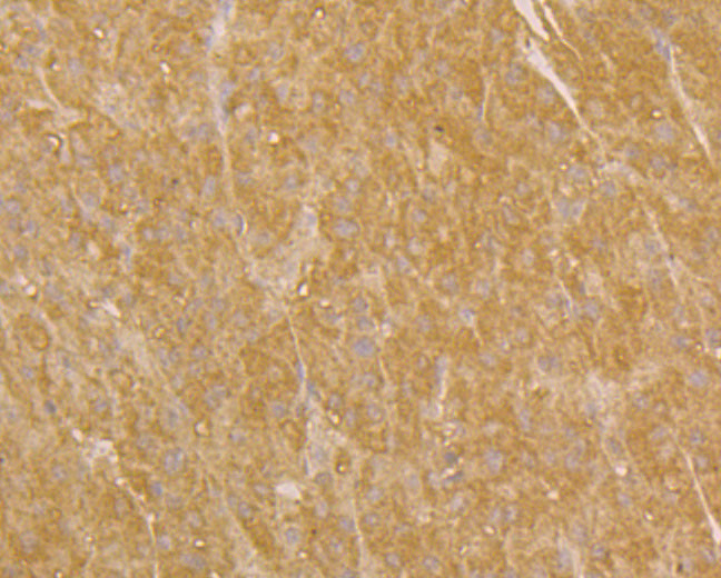 UQCRC2 Antibody in Immunohistochemistry (Paraffin) (IHC (P))