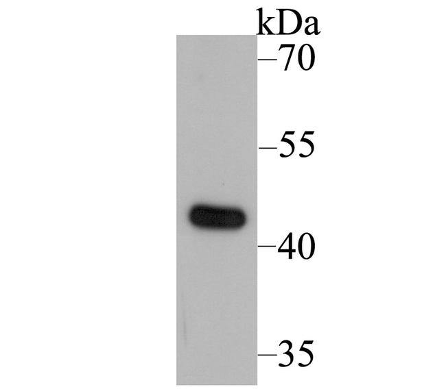 UQCRC2 Antibody in Western Blot (WB)