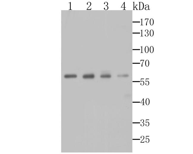 alpha-1 Microglobulin Antibody in Western Blot (WB)