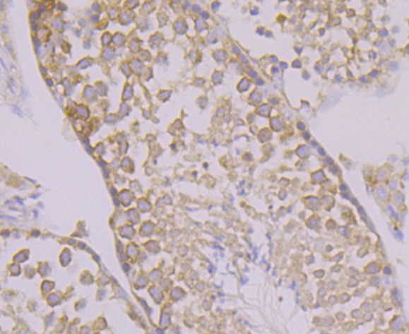 Calnexin Antibody in Immunohistochemistry (Paraffin) (IHC (P))