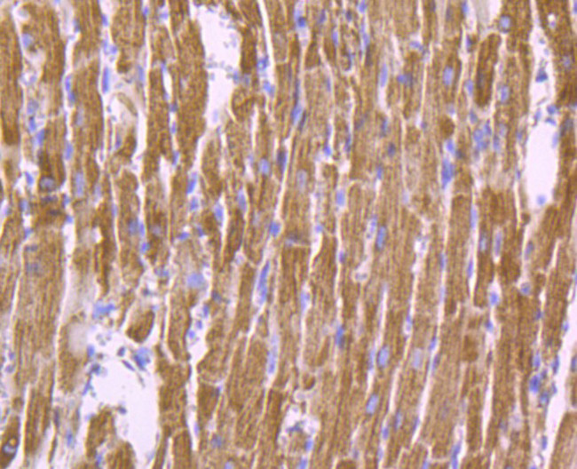 SDHB Antibody in Immunohistochemistry (Paraffin) (IHC (P))