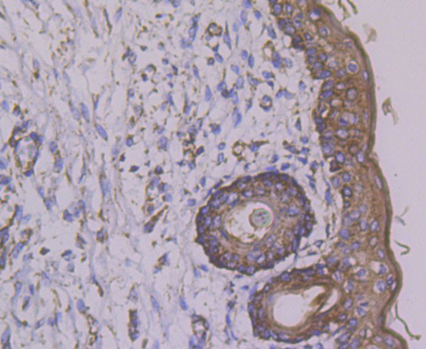 SDHB Antibody in Immunohistochemistry (Paraffin) (IHC (P))