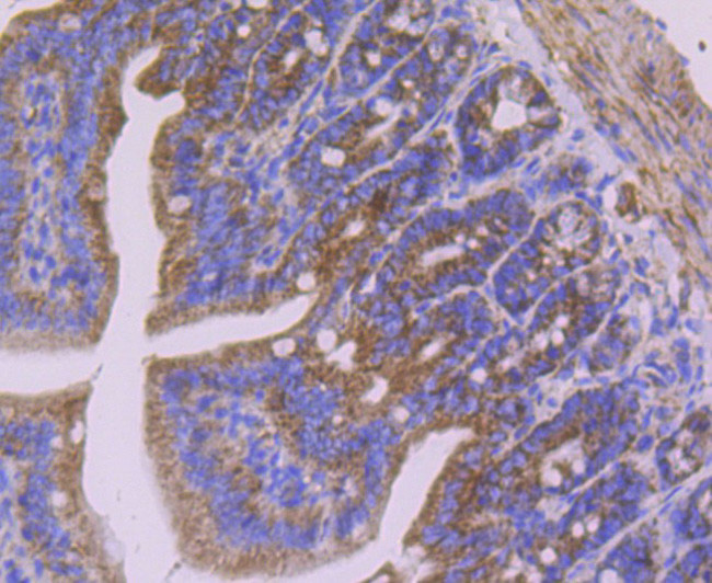 SDHB Antibody in Immunohistochemistry (Paraffin) (IHC (P))