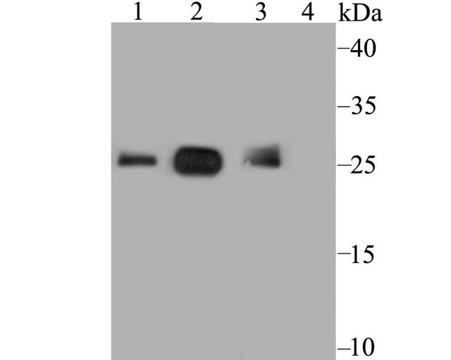 SDHB Antibody in Western Blot (WB)