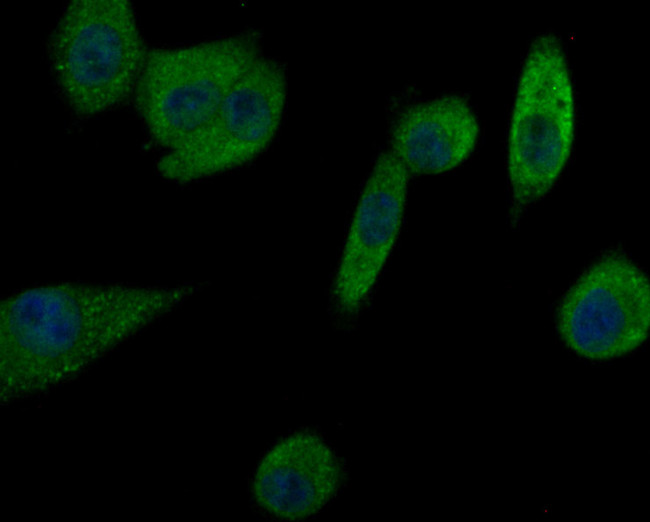 Prolactin Antibody in Immunocytochemistry (ICC/IF)