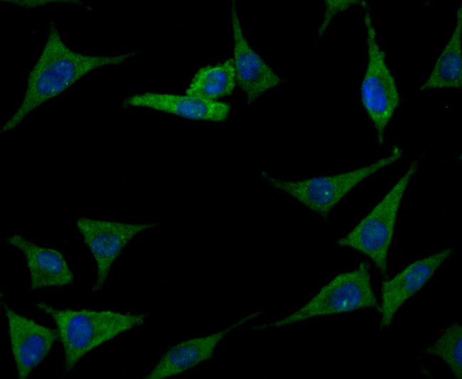 Prolactin Antibody in Immunocytochemistry (ICC/IF)