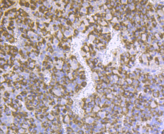 Prolactin Antibody in Immunohistochemistry (Paraffin) (IHC (P))