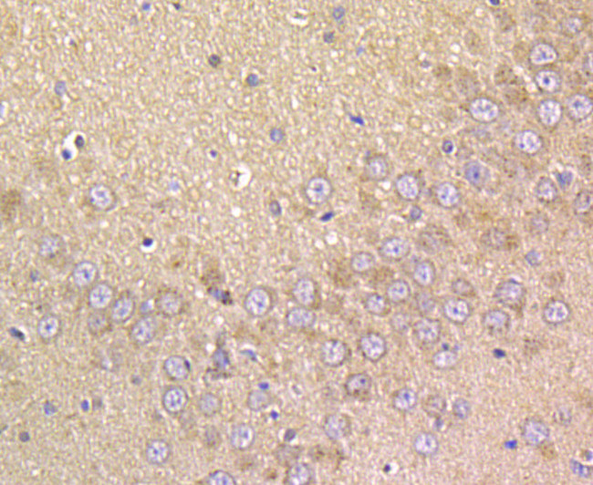 Prolactin Antibody in Immunohistochemistry (Paraffin) (IHC (P))