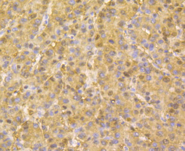 Aminoacylase Antibody in Immunohistochemistry (Paraffin) (IHC (P))