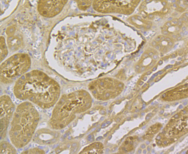 Aminoacylase Antibody in Immunohistochemistry (Paraffin) (IHC (P))