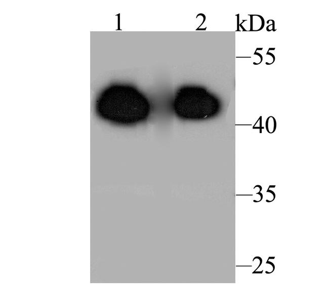 Aminoacylase Antibody in Western Blot (WB)