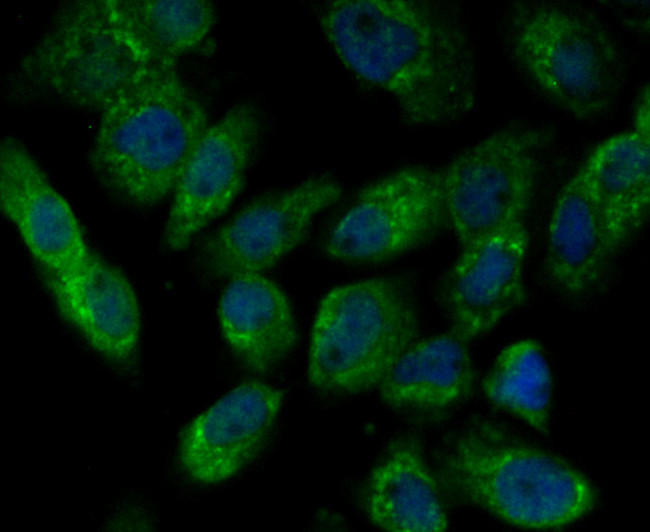 ILK Antibody in Immunocytochemistry (ICC/IF)