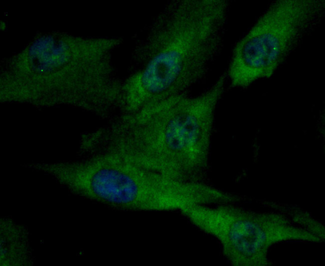 ILK Antibody in Immunocytochemistry (ICC/IF)