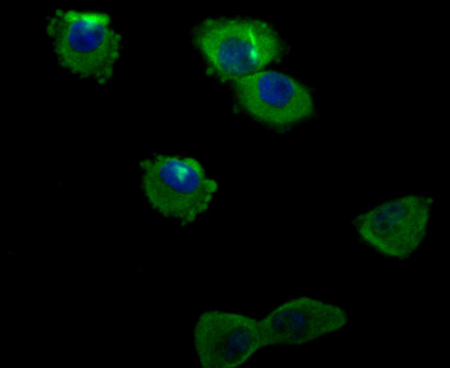 ILK Antibody in Immunocytochemistry (ICC/IF)