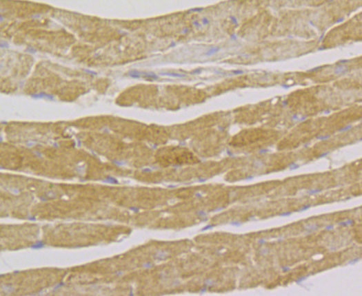 ILK Antibody in Immunohistochemistry (Paraffin) (IHC (P))