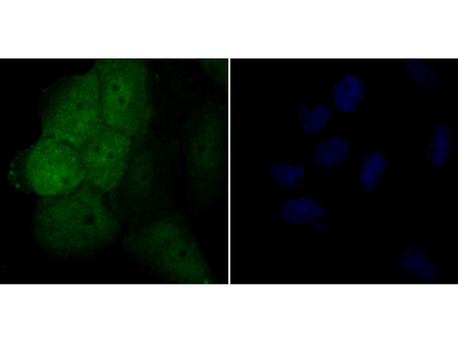 Galectin 3 Antibody in Immunocytochemistry (ICC/IF)