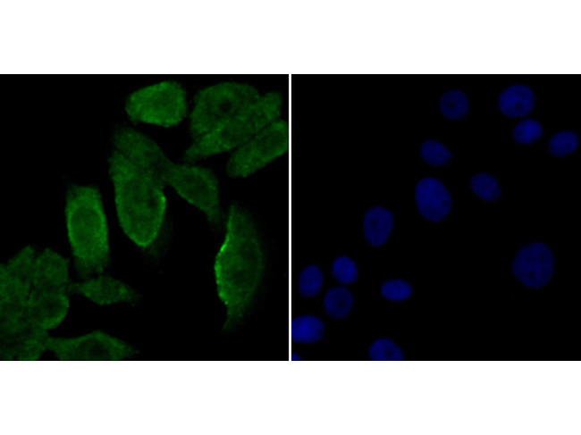 Galectin 3 Antibody in Immunocytochemistry (ICC/IF)