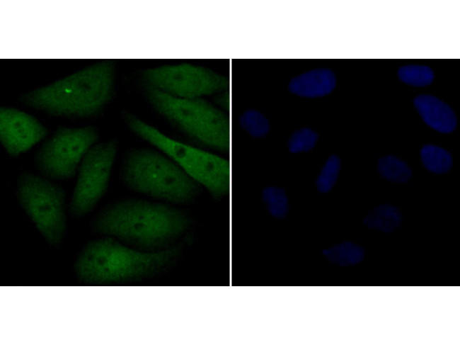 Galectin 3 Antibody in Immunocytochemistry (ICC/IF)