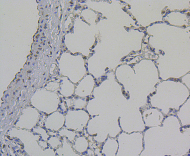 Galectin 3 Antibody in Immunohistochemistry (Paraffin) (IHC (P))