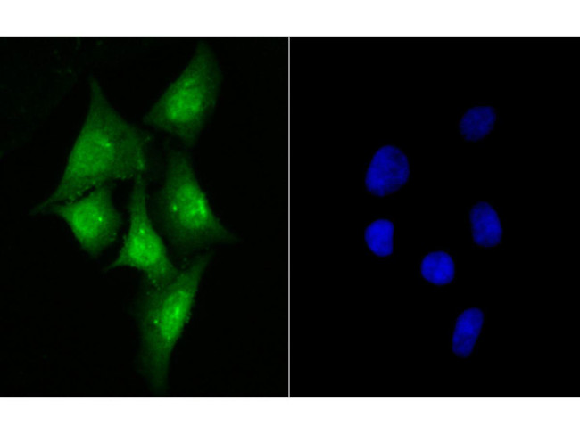 delta Catenin Antibody in Immunocytochemistry (ICC/IF)