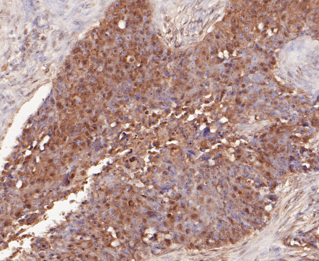 delta Catenin Antibody in Immunohistochemistry (Paraffin) (IHC (P))