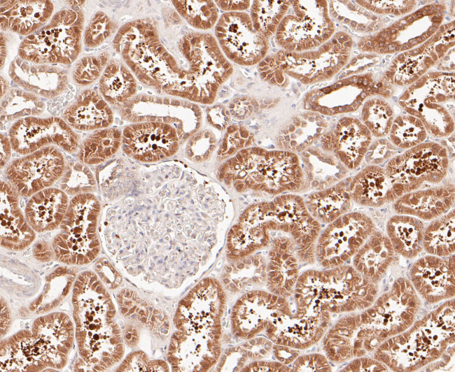 delta Catenin Antibody in Immunohistochemistry (Paraffin) (IHC (P))