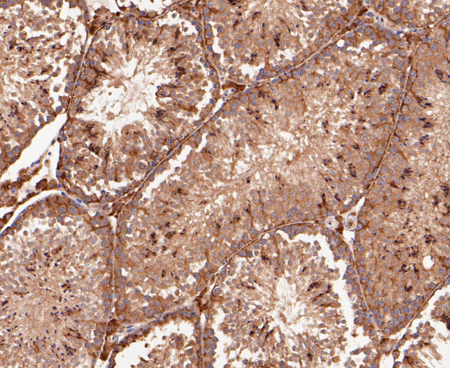 delta Catenin Antibody in Immunohistochemistry (Paraffin) (IHC (P))