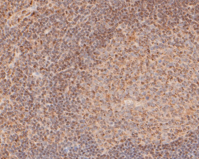 FOXP1 Antibody in Immunohistochemistry (Paraffin) (IHC (P))