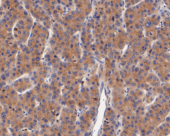 DOG-1 Antibody in Immunohistochemistry (Paraffin) (IHC (P))