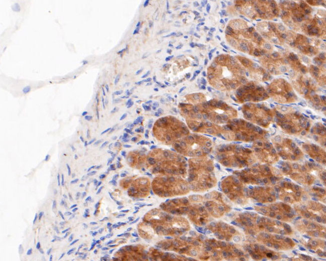 GSDMD Antibody in Immunohistochemistry (Paraffin) (IHC (P))