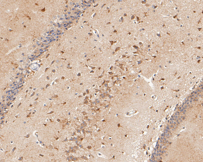 P2X2 Antibody in Immunohistochemistry (Paraffin) (IHC (P))