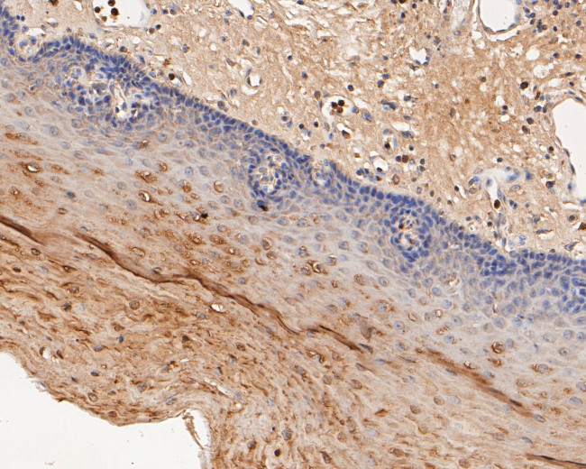 P2X2 Antibody in Immunohistochemistry (Paraffin) (IHC (P))