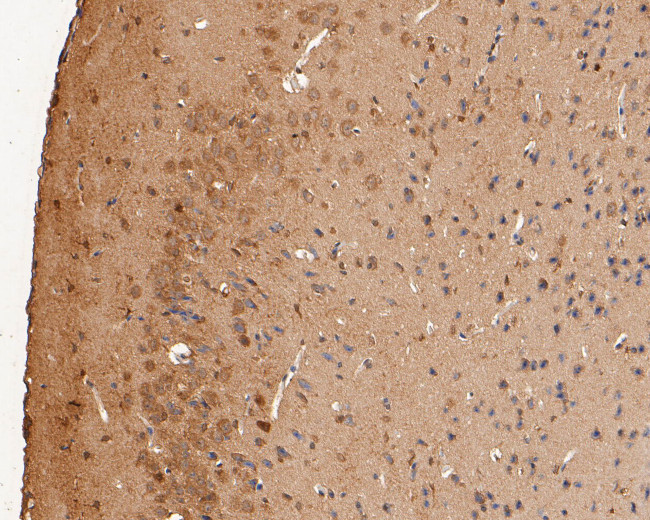 P2X2 Antibody in Immunohistochemistry (Paraffin) (IHC (P))