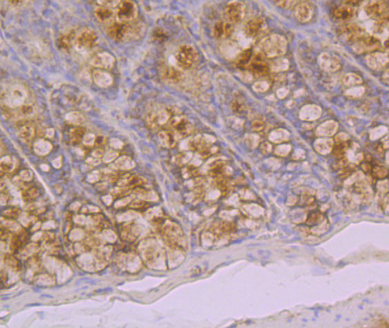 Galectin 4 Antibody in Immunohistochemistry (Paraffin) (IHC (P))