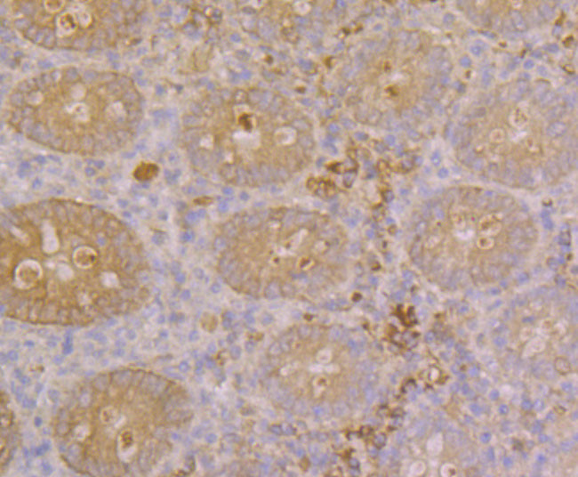 Galectin 4 Antibody in Immunohistochemistry (Paraffin) (IHC (P))