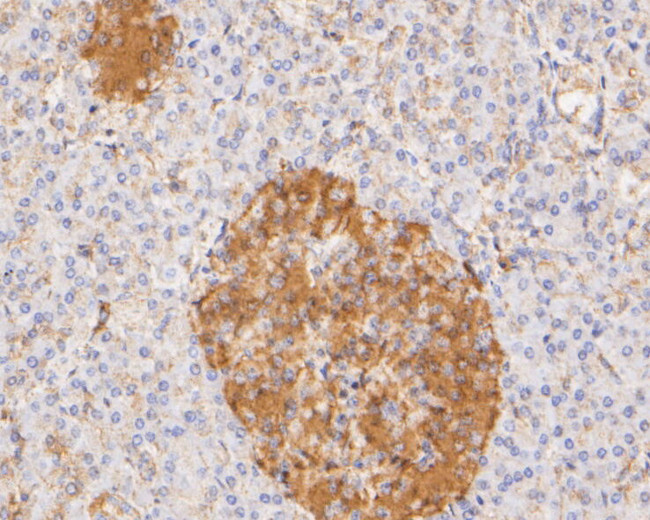 PYCR1 Antibody in Immunohistochemistry (Paraffin) (IHC (P))