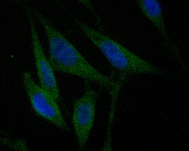 CHRNB2 Antibody in Immunocytochemistry (ICC/IF)